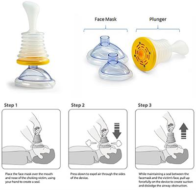 Use of a Novel Portable Non-powered Suction Device in Patients With Oropharyngeal Dysphagia During a Choking Emergency